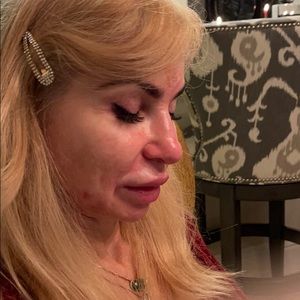 Meet your Posher, Robert